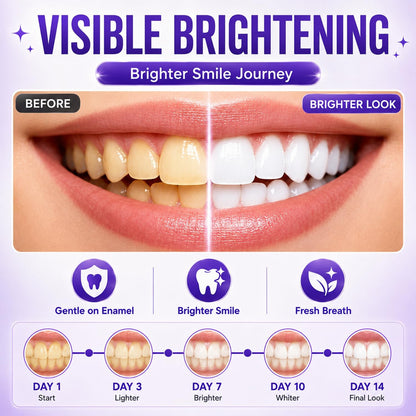 PearlFix™ Purple Whitening Strips